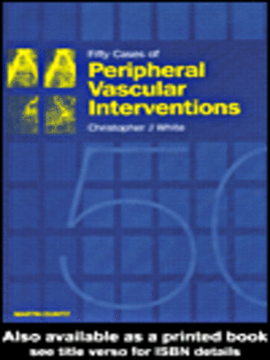 cover image of Fifty Cases of Peripheral Vascular Interventions